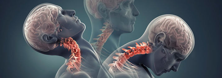 Chiropractic Los Angeles CA Personal Injury Chiropractic Los Angeles CA Personal Injury